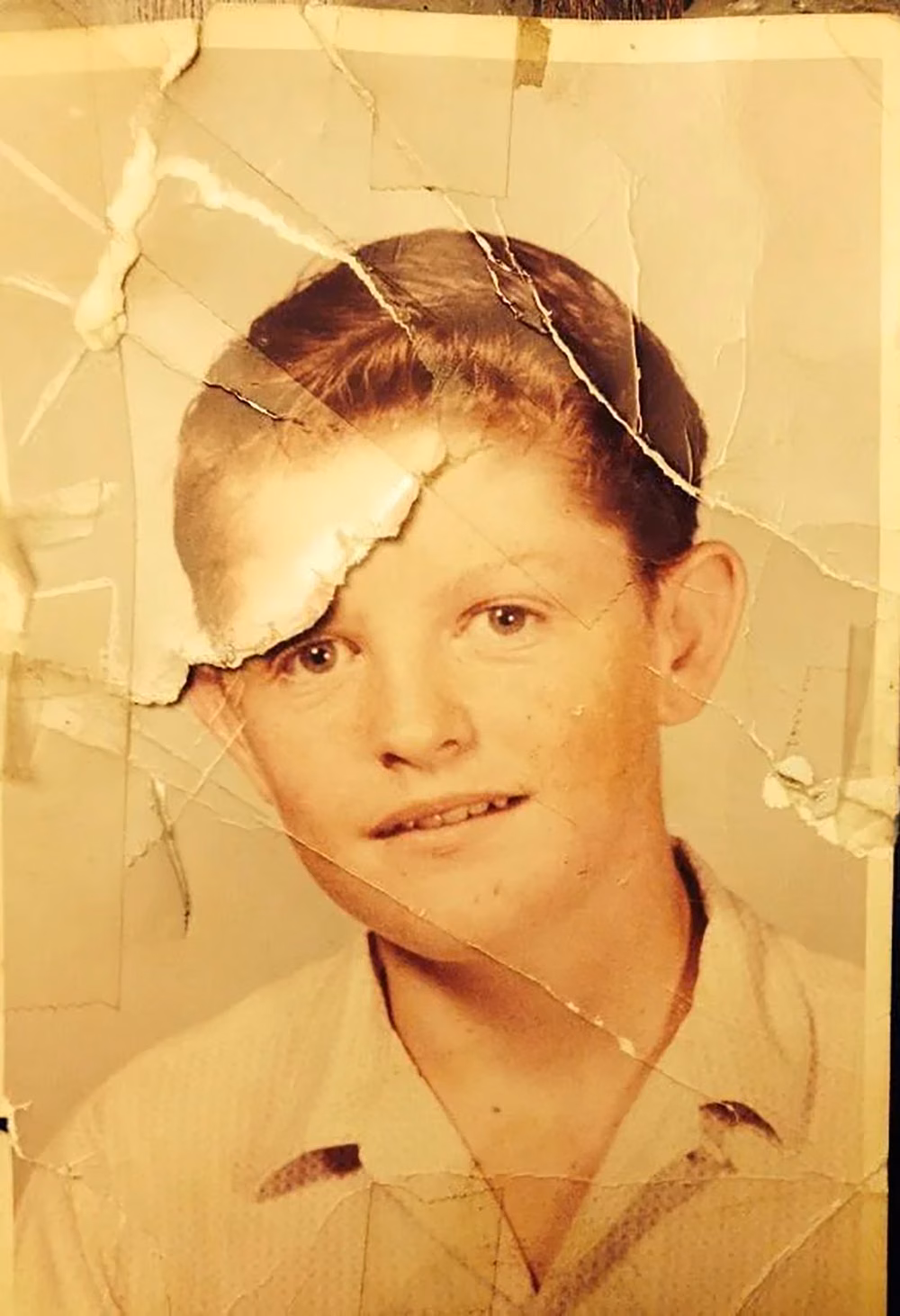 1960s portrait of a boy with a deep tear running across his face
